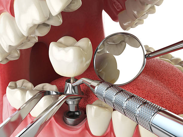 Best Knocked-Out Tooth Emergency  in Walton Hills, OH